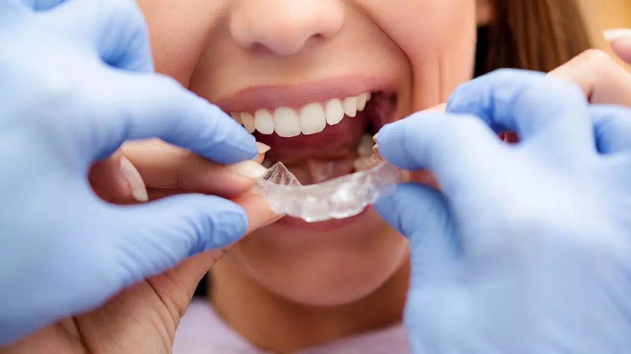 Role in Post Orthodontic Treatment